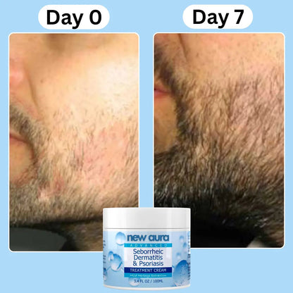 Natural Beard Relief Balm